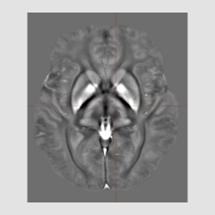 MRI image for Grand Rounds promotion