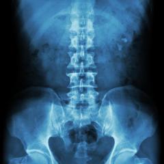 Xray